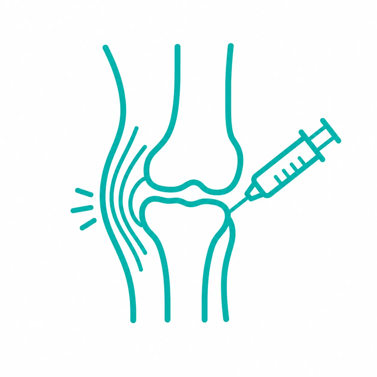 Proloterapia